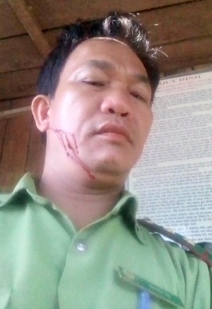 Quảng Nam Một kiểm lâm viên bị “lâm tặc” hành hung, gây thương tích