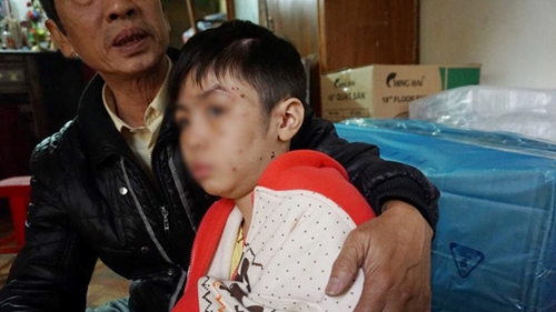 Vụ bạo hành trẻ em tại Hà Nội Có thể phạt tới 3 năm tù giam