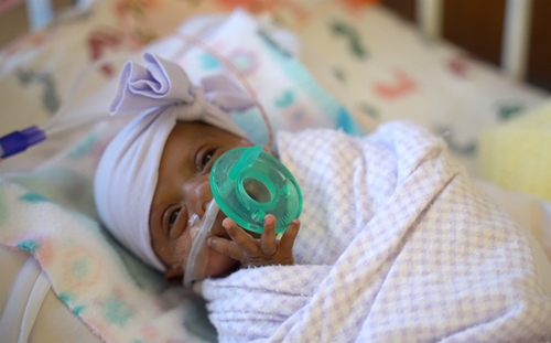 Sức sống diệu kỳ của em bé sơ sinh nhỏ nhất thế giới