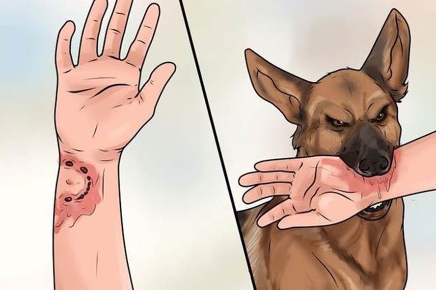 Bị chó cắn là một trải nghiệm đáng sợ, nhưng không phải là không thể đối phó được. Click ngay để xem hình ảnh và tìm hiểu cách đối phó đúng cách khi bị chó cắn.