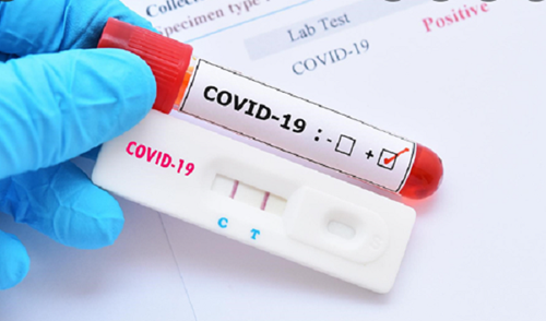 Phí xét nghiệm COVID-19 có thuộc đối tượng chịu thuế