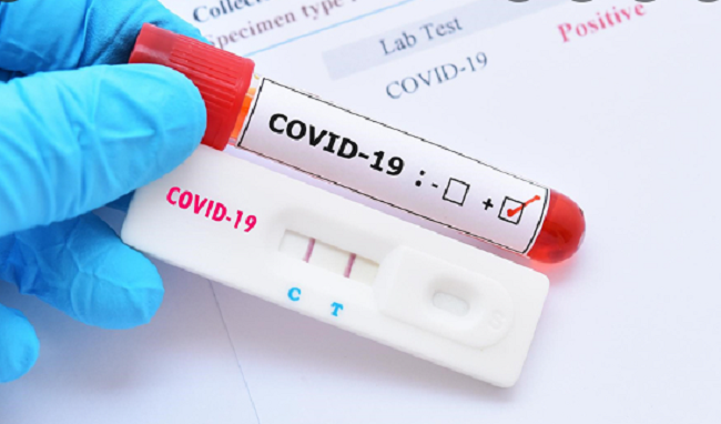 Hình ảnh: Phí xét nghiệm COVID-19 có thuộc đối tượng chịu thuế? số 1