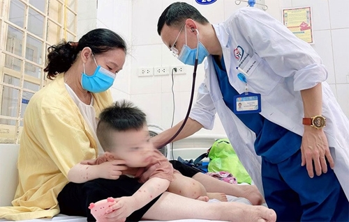 Hà Nội Xuất hiện chùm ca bệnh tay chân miệng, thủy đậu trong trường học