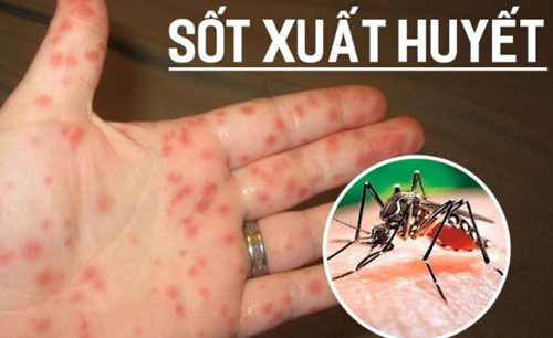 Hà Nam chủ động triển khai các biện pháp phòng chống sốt xuất huyết