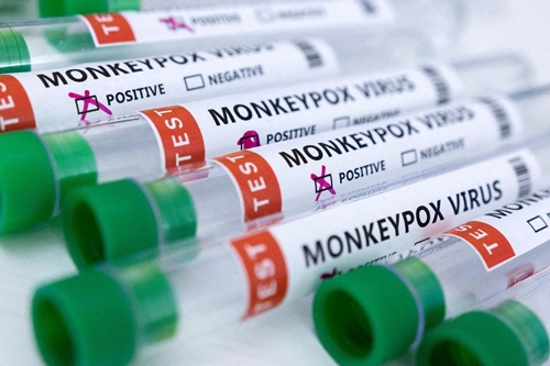 Premiers décès de patients contaminés par la variole du singe hors d’Afrique